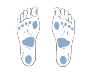 Neuropatie diabetica